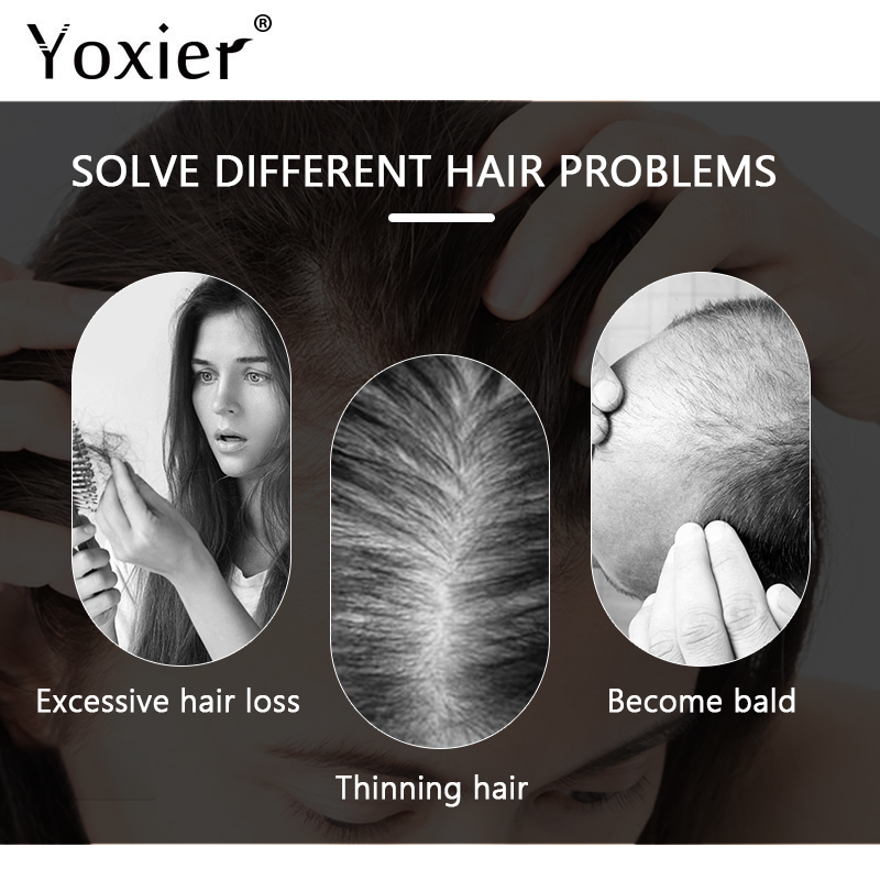 Intensive Growth Serum Prevent - Hair Care Treatment review and price