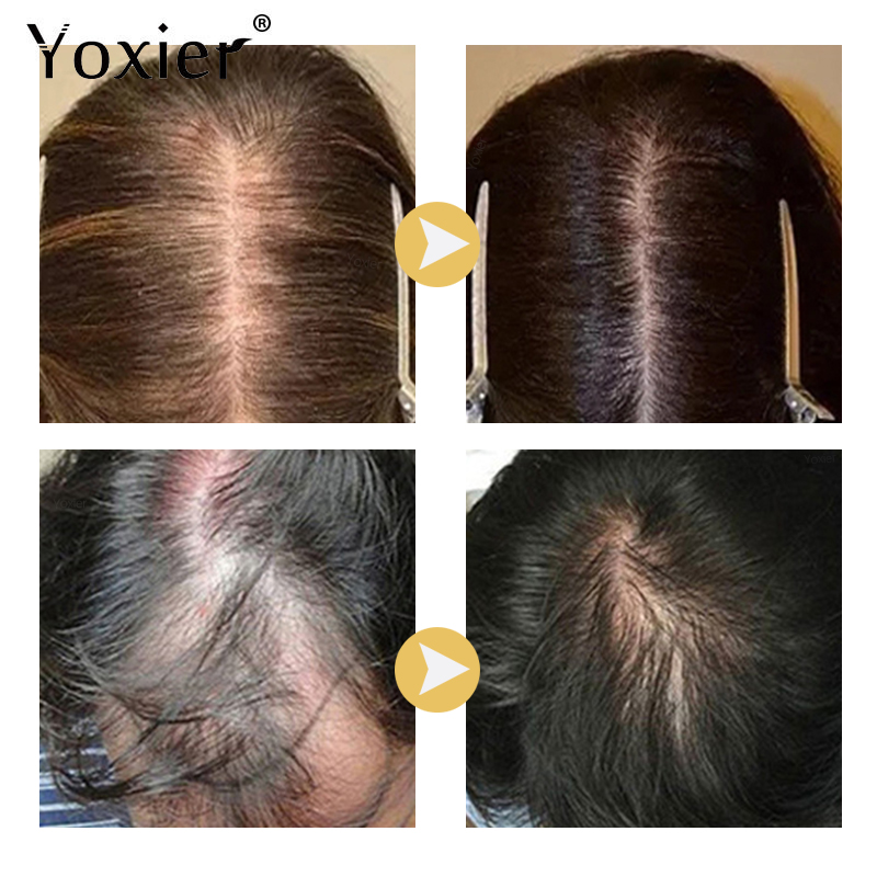 Intensive Growth Serum Prevent - Hair Care Treatment review and price